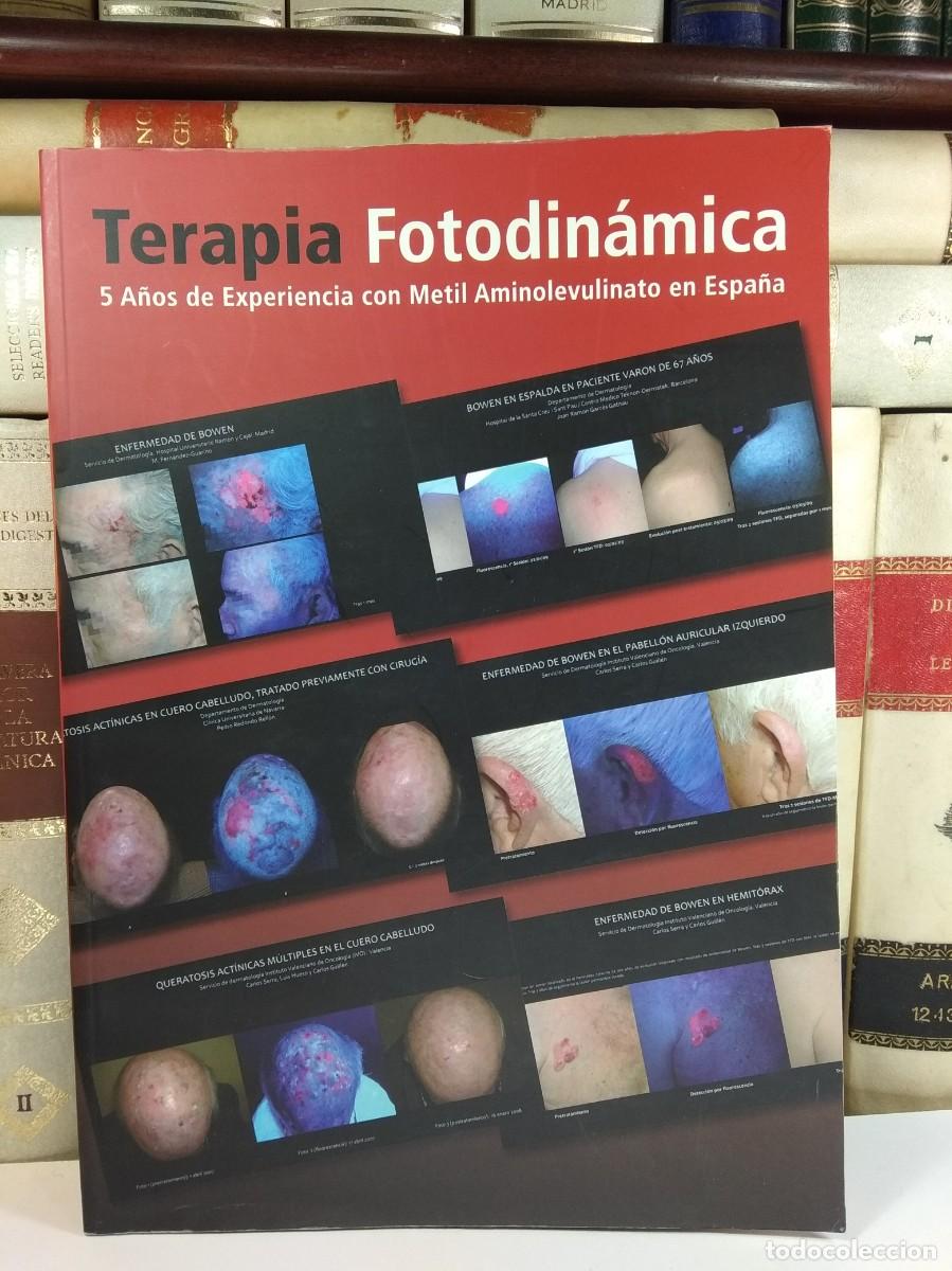 Second hand books: TERAPIA FOTODIN&Aacute;MICA. 5 a&ntilde;os de experiencia con Metil Aminolevulinato en Espa&ntilde;a.