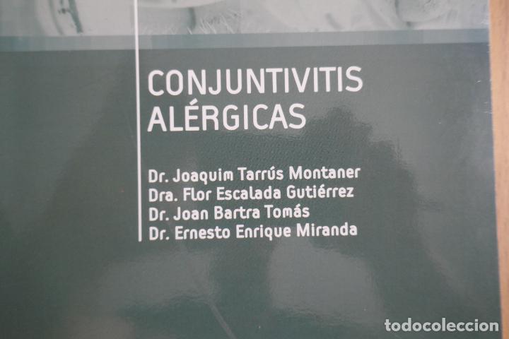 Libros de segunda mano: Conjuntivitis al&eacute;rgicas - Foto 2
