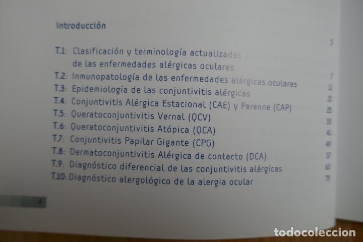 Libros de segunda mano: Conjuntivitis al&eacute;rgicas - Foto 6