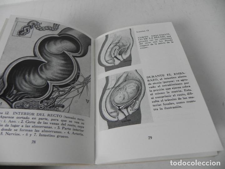 Libros de segunda mano: ESTRE&Ntilde;IMIENTO (DR. VANDER) - EDICIONES ADRIAN VENDER-1967 - Foto 3