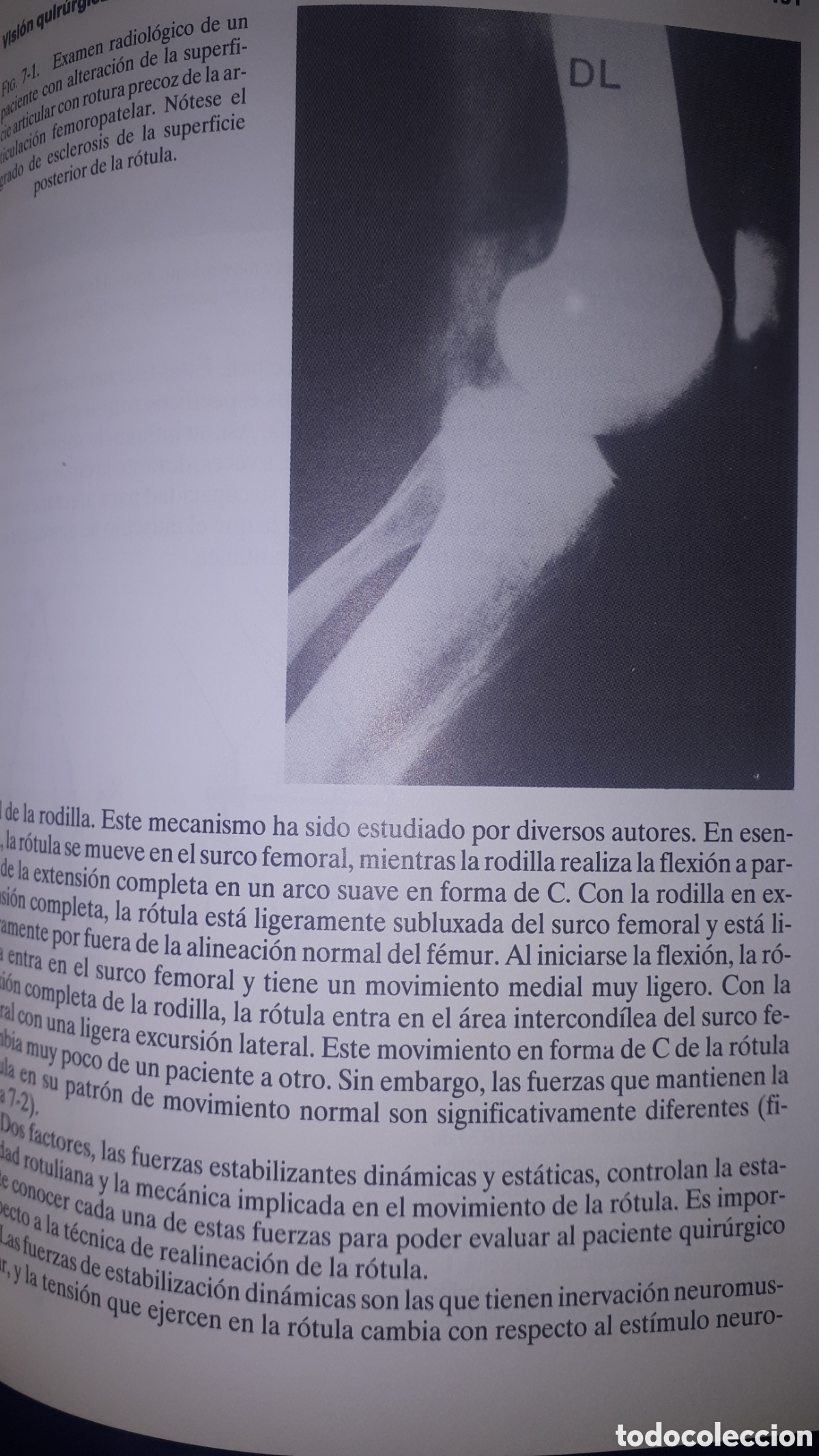 Libros de segunda mano: FISIOTERAPIA DE LA RODILLA ROBERT E. MANGINE - Foto 2