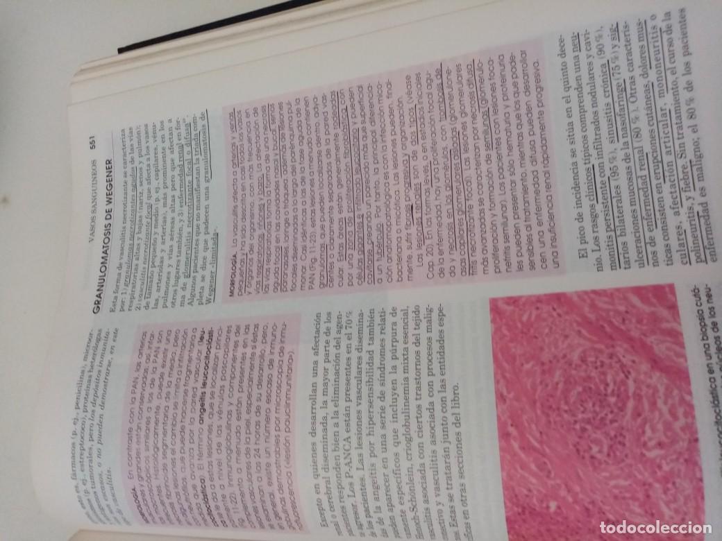 Libros de segunda mano: PATOLOGIA ESTRUCTURAL Y FUNCIONAL. EST1B4 - Foto 2