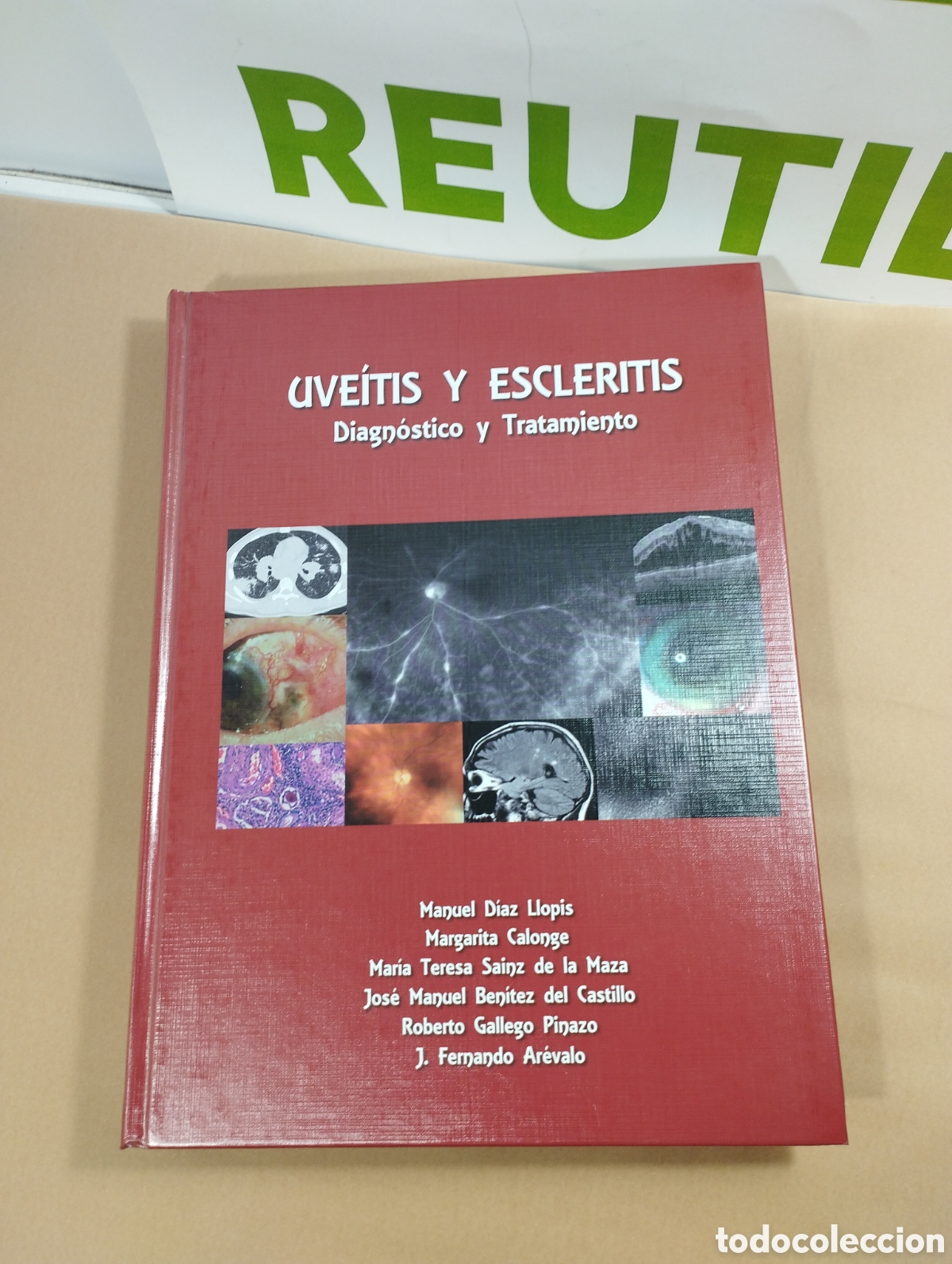 Libros de segunda mano: Uveitis y escleritis. Diagnostico y tratamiento. - Foto 1