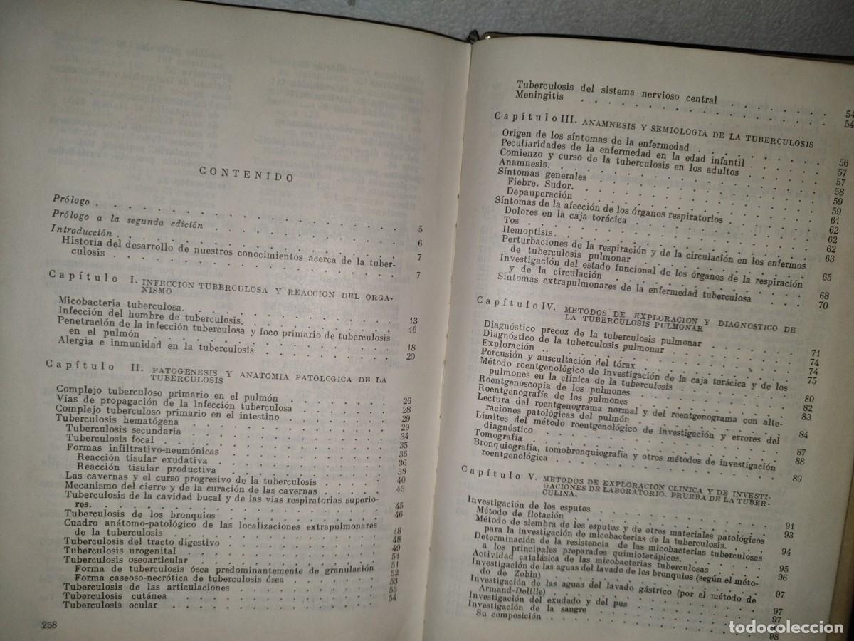 Libros de segunda mano: 9- TUBERCULOSIS - V. EINIS - 70S - Foto 5