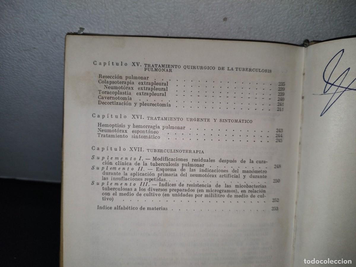 Libros de segunda mano: 9- TUBERCULOSIS - V. EINIS - 70S - Foto 7