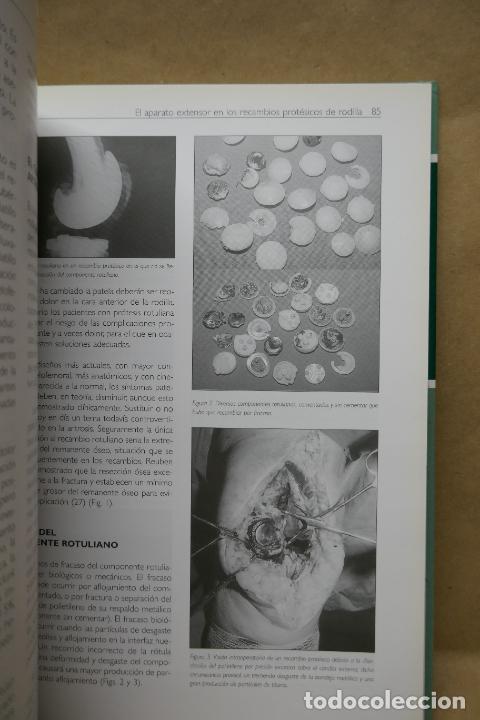 Libros de segunda mano: RECAMBIOS PROT&Eacute;SICOS DE RODILLA. - Foto 11