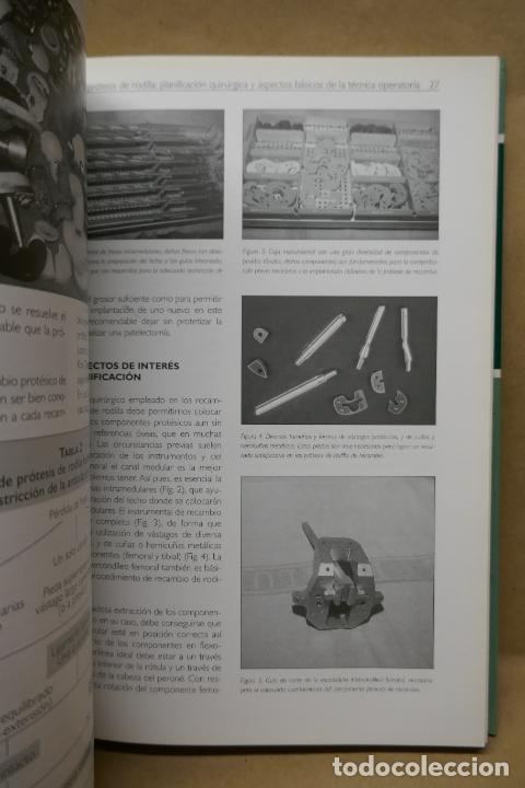 Libros de segunda mano: RECAMBIOS PROT&Eacute;SICOS DE RODILLA. - Foto 13