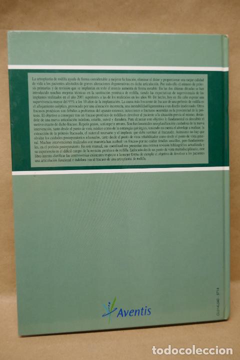 Libros de segunda mano: RECAMBIOS PROT&Eacute;SICOS DE RODILLA. - Foto 17