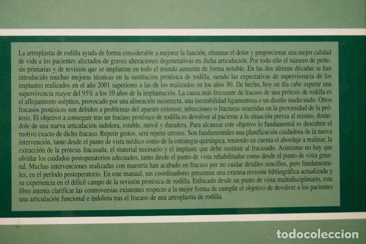 Libros de segunda mano: RECAMBIOS PROT&Eacute;SICOS DE RODILLA. - Foto 18
