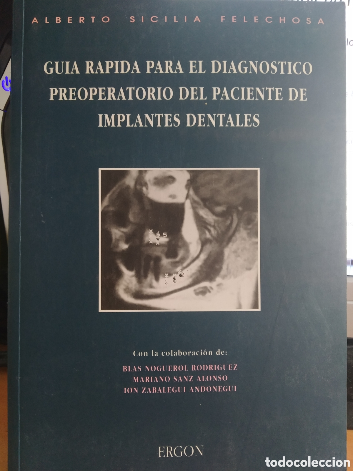 Libri di seconda mano: GU&Iacute;A R&Aacute;PIDA PARA EL DIAGN&Oacute;STICO PREOPERATORIO DEL PACIENTE DE IMPLANTES DENTALES. SICILIA FELECHOSA
