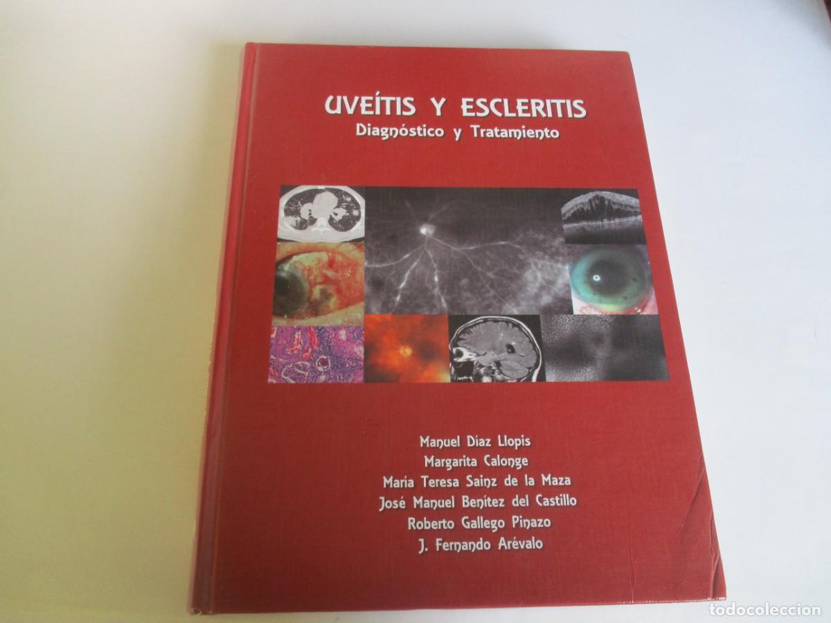 Libros de segunda mano: VV.AA. Uve&iacute;tis y escleritis W21980 - Foto 1