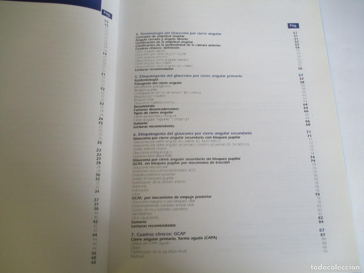 Libros de segunda mano: El glaucoma por cierre angular W21999 - Foto 3