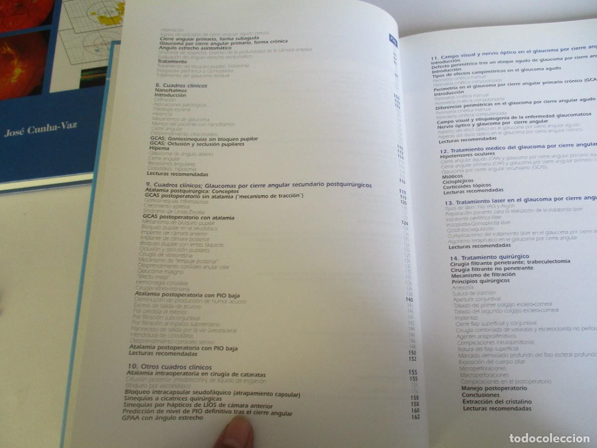 Libros de segunda mano: El glaucoma por cierre angular W21999 - Foto 4