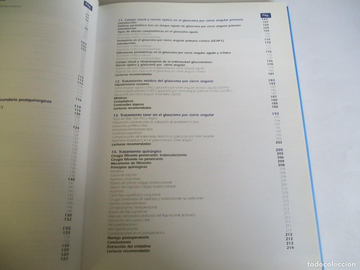Libros de segunda mano: El glaucoma por cierre angular W21999 - Foto 5