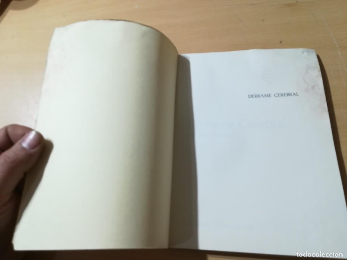 Libros de segunda mano: DERRAME CEREBRAL / JAVIER LACARRA / AO-84 - Foto 4