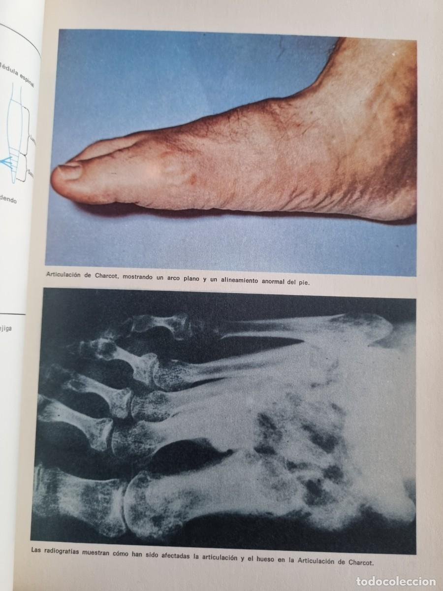 Libros de segunda mano: IMPLICACIONES DE LA HIPERGLUCEMIA. ED: PFIZER. 1972 - Foto 8