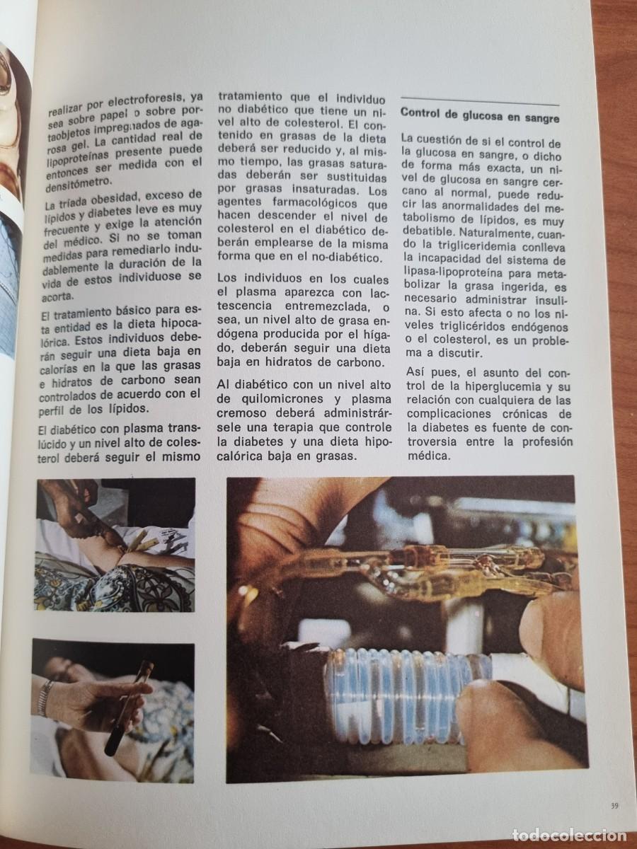 Libros de segunda mano: IMPLICACIONES DE LA HIPERGLUCEMIA. ED: PFIZER. 1972 - Foto 10