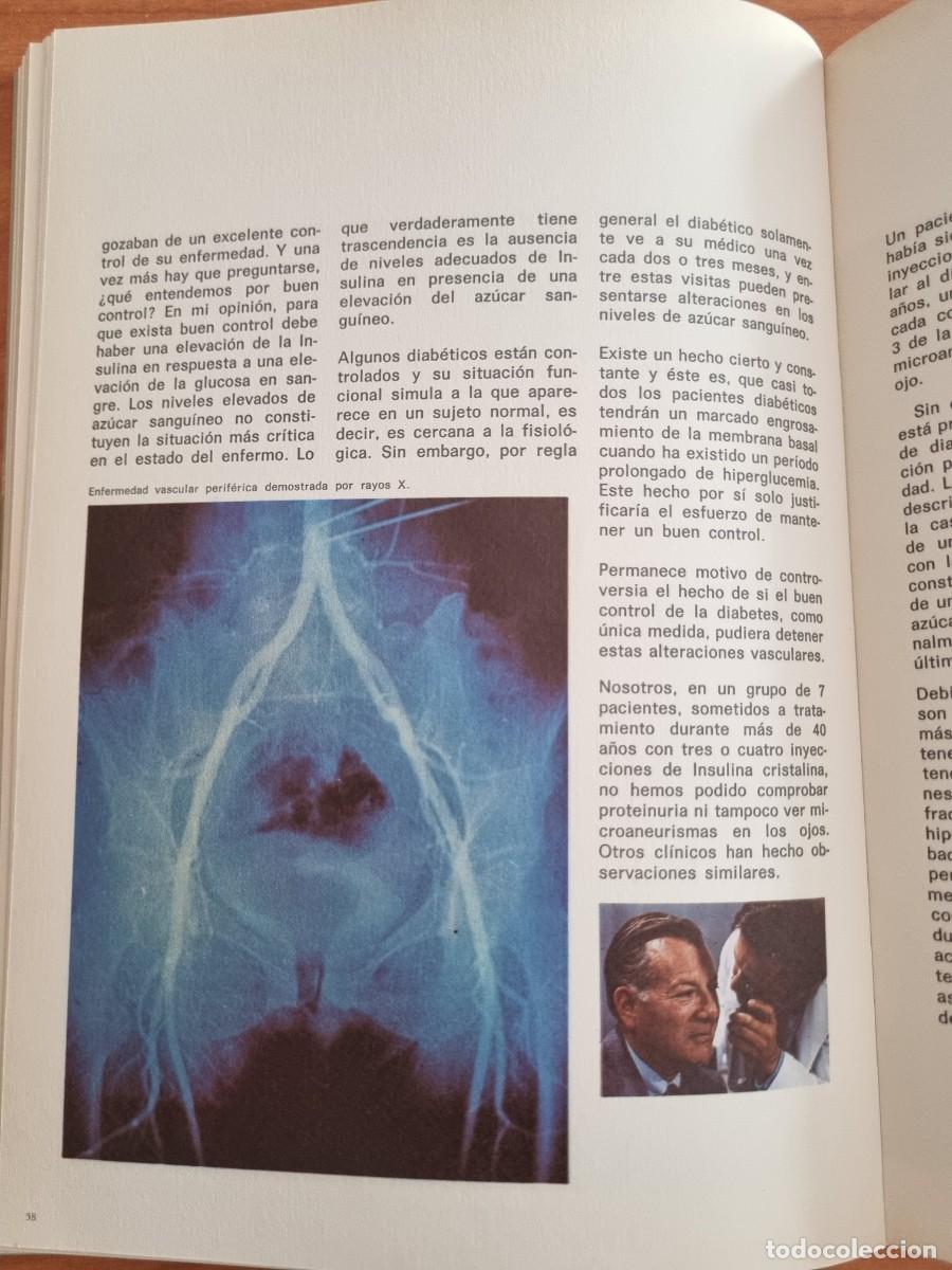 Libros de segunda mano: IMPLICACIONES DE LA HIPERGLUCEMIA. ED: PFIZER. 1972 - Foto 12