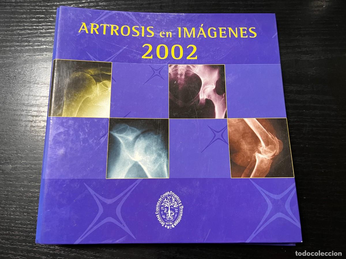 Second hand books: ARTROSIS EN IM&Aacute;GENES. 2002. SOCIEDAD ESPA&Ntilde;OLA DE CIRUG&Iacute;A ORTOP&Eacute;DICA Y TRAUMATOLOG&Iacute;A. VER
