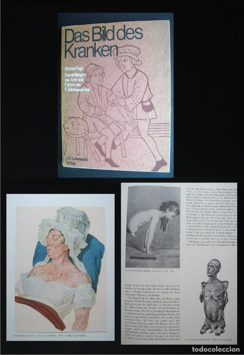 Second hand books: LA IMAGEN DE LA PERSONA ENFERMA. DAS BILD DES KRANKEN.