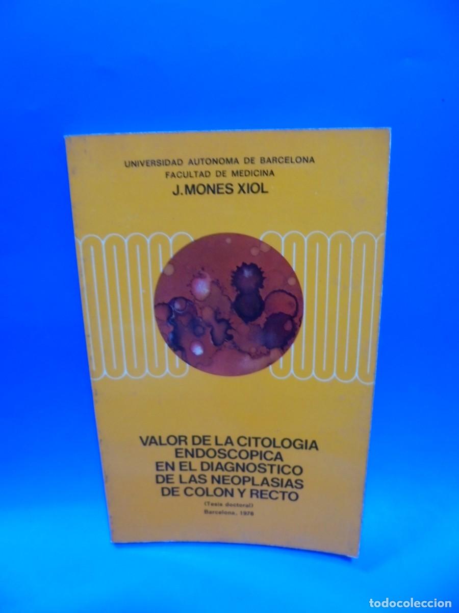 Second hand books: VALOR DE LA CITOLOGIA ENDOSCOPICA EN EL DIAGNOSTICO DE LAS NEOPLASIAS DE COLON. 1976. PAGS : 100.