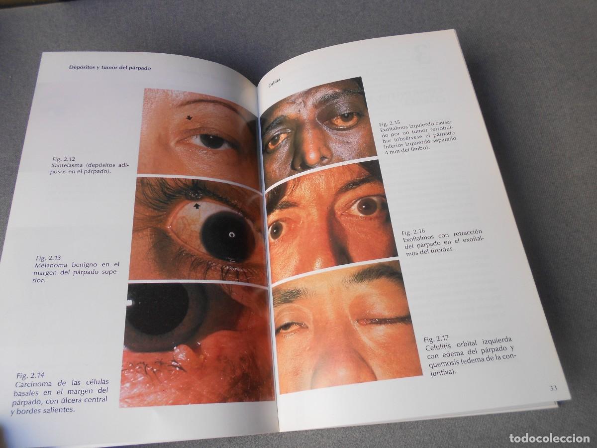 Libros de segunda mano: ATLAS EN COLOR DE OFTALMOLOGIA - Foto 4
