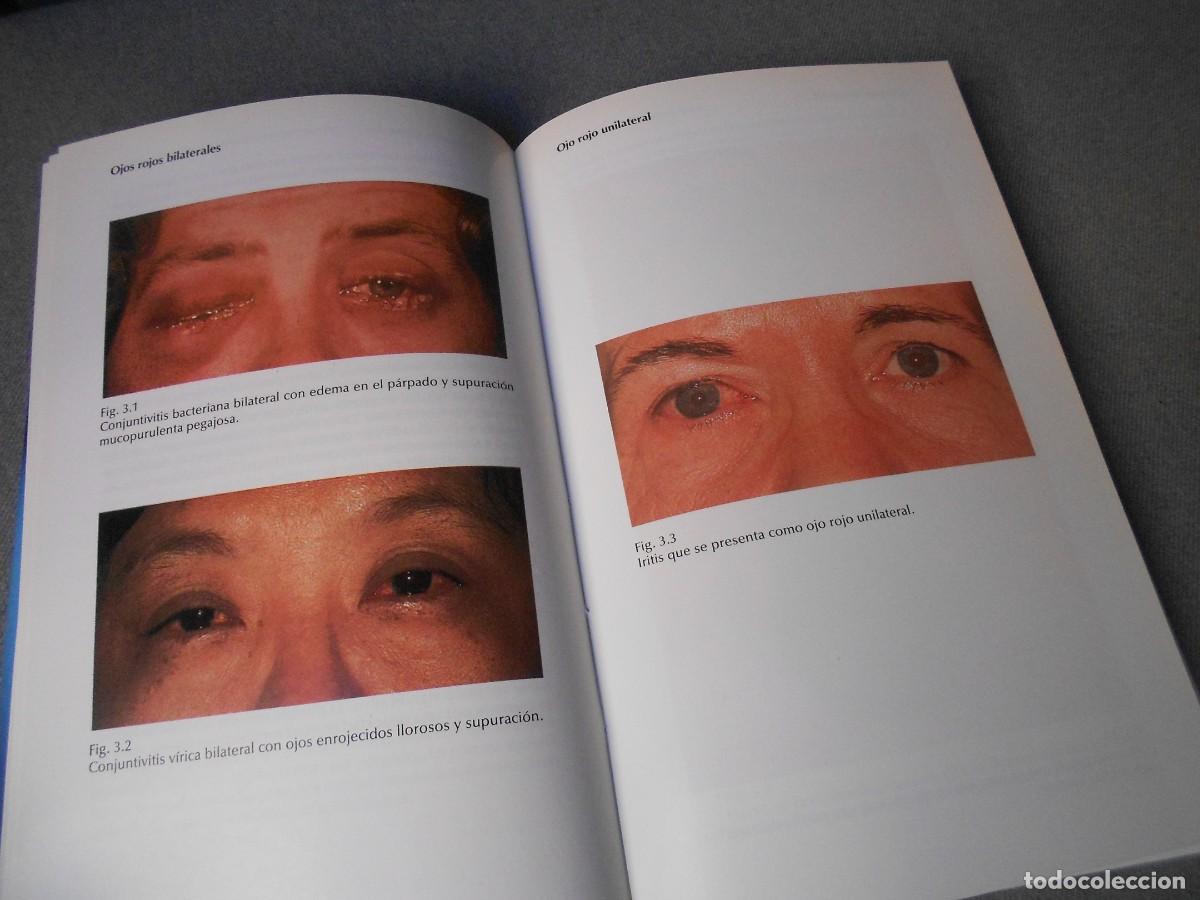 Libros de segunda mano: ATLAS EN COLOR DE OFTALMOLOGIA - Foto 5