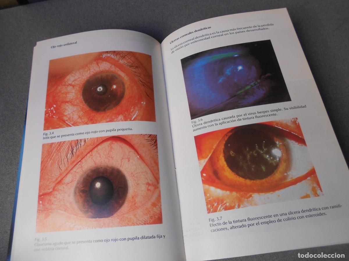 Libros de segunda mano: ATLAS EN COLOR DE OFTALMOLOGIA - Foto 6