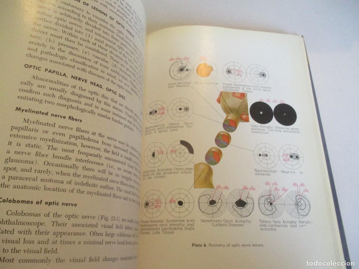 Libros de segunda mano: DAVID O. HARRINGTON The visual fields (ingl&eacute;s) W23539 - Foto 3