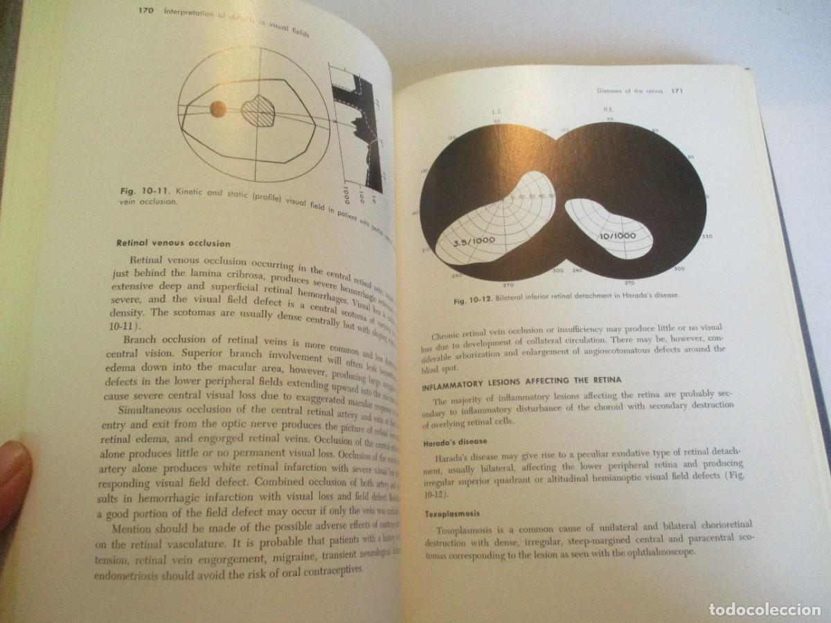 Libros de segunda mano: DAVID O. HARRINGTON The visual fields (ingl&eacute;s) W23539 - Foto 4