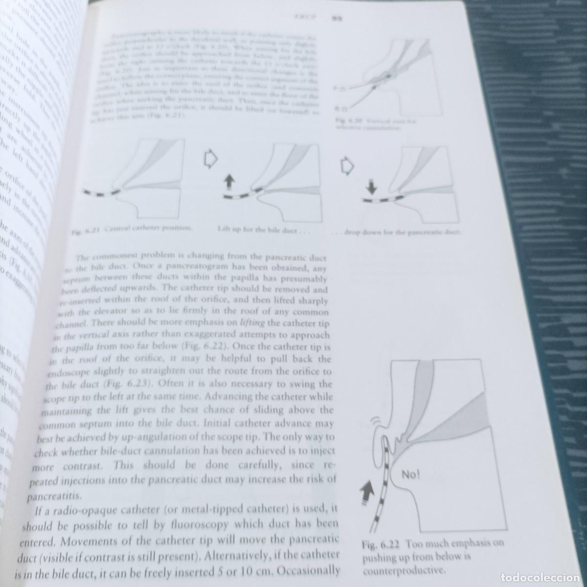 Libros de segunda mano: PRACTICAL GASTROINTESTINAL ENDOSCOPY,PETER B.COTTON,CHRISTOPHER B.WILLIAM,1990,289 PAG. - Foto 3