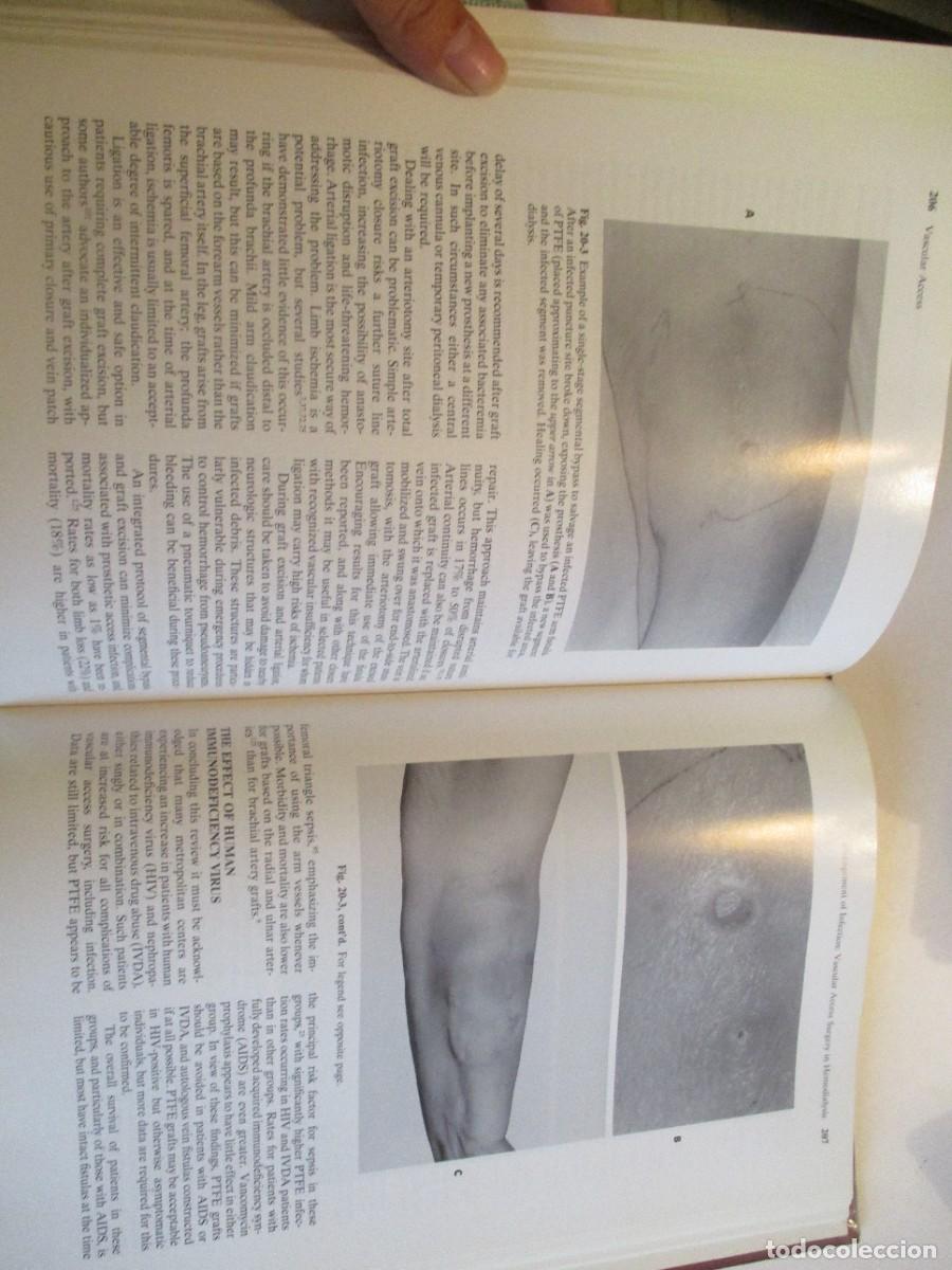 Libros de segunda mano: SAMUEL ERIC WILSON Vascular access Principles and practice (ingl&eacute;s) W23845 - Foto 4