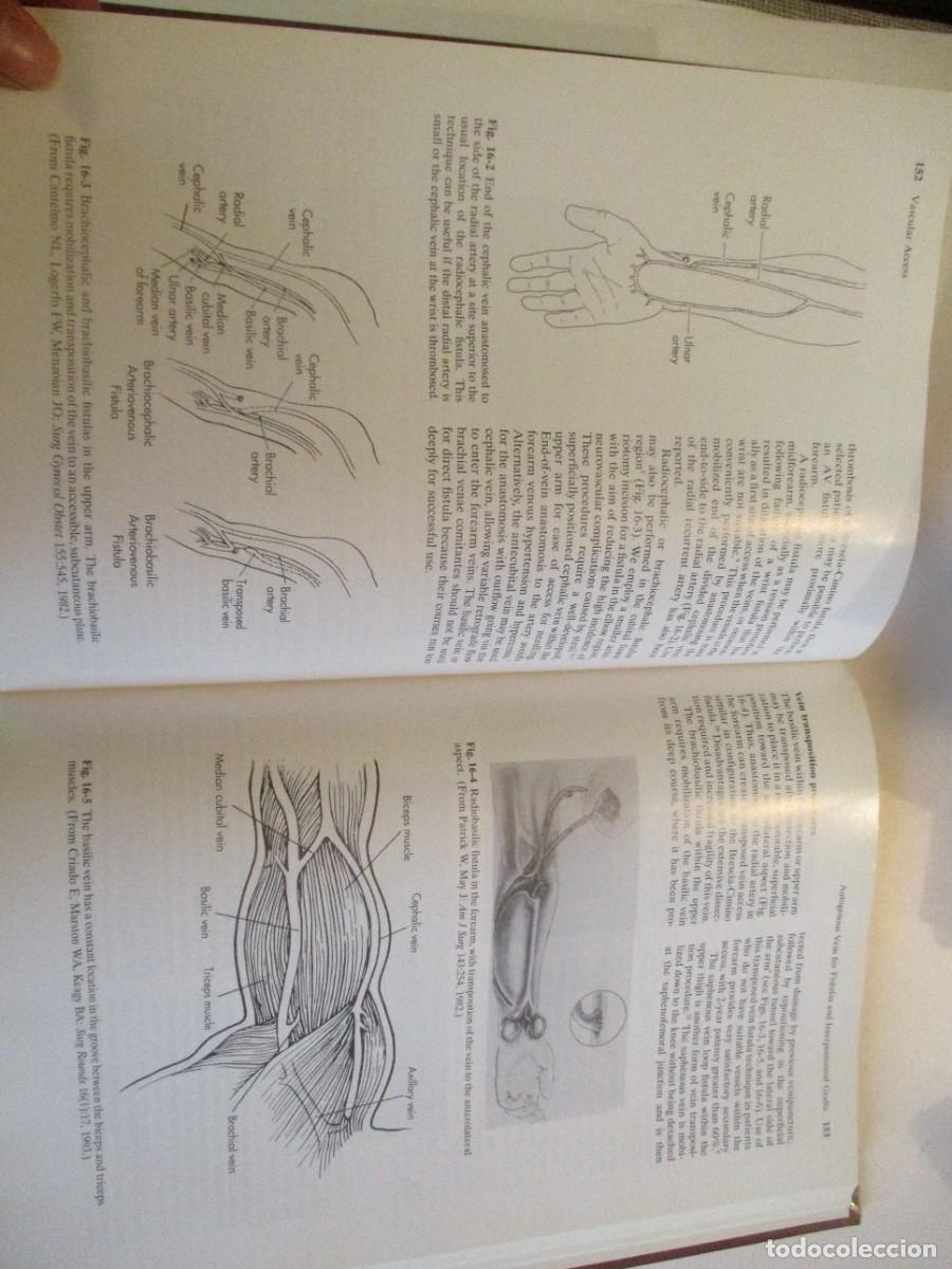 Libros de segunda mano: SAMUEL ERIC WILSON Vascular access Principles and practice (ingl&eacute;s) W23845 - Foto 5
