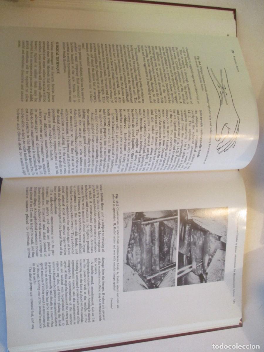 Libros de segunda mano: SAMUEL ERIC WILSON Vascular access Principles and practice (ingl&eacute;s) W23845 - Foto 6