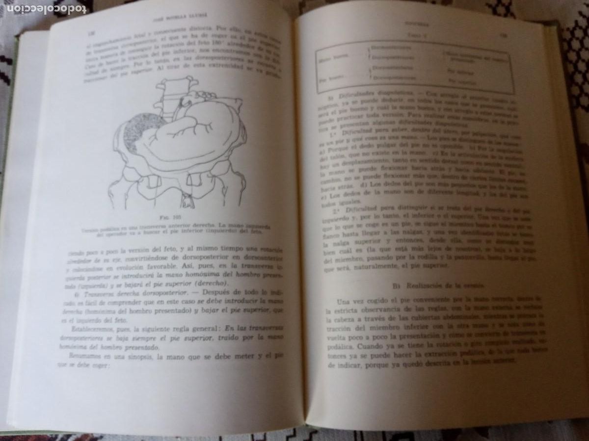Libros de segunda mano: Tocurgia.-Dr. Jos&eacute; Botella Llusi&aacute;. - Foto 6