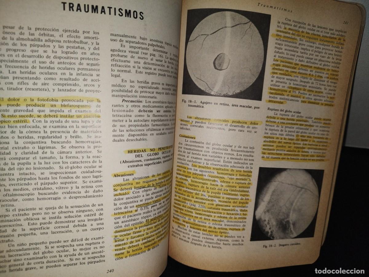 Libros de segunda mano: 85- OFTALMOLOG&Iacute;A GENERAL - DR. DANIEL VAUGHAN - Foto 9