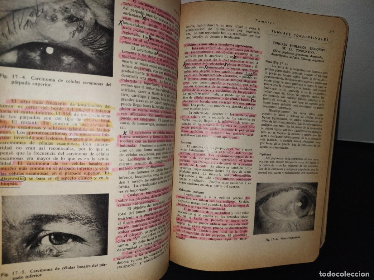 Libros de segunda mano: 85- OFTALMOLOG&Iacute;A GENERAL - DR. DANIEL VAUGHAN - Foto 10