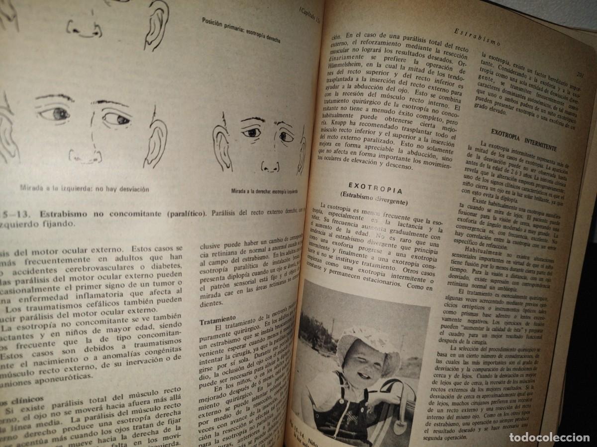 Libros de segunda mano: 85- OFTALMOLOG&Iacute;A GENERAL - DR. DANIEL VAUGHAN - Foto 11
