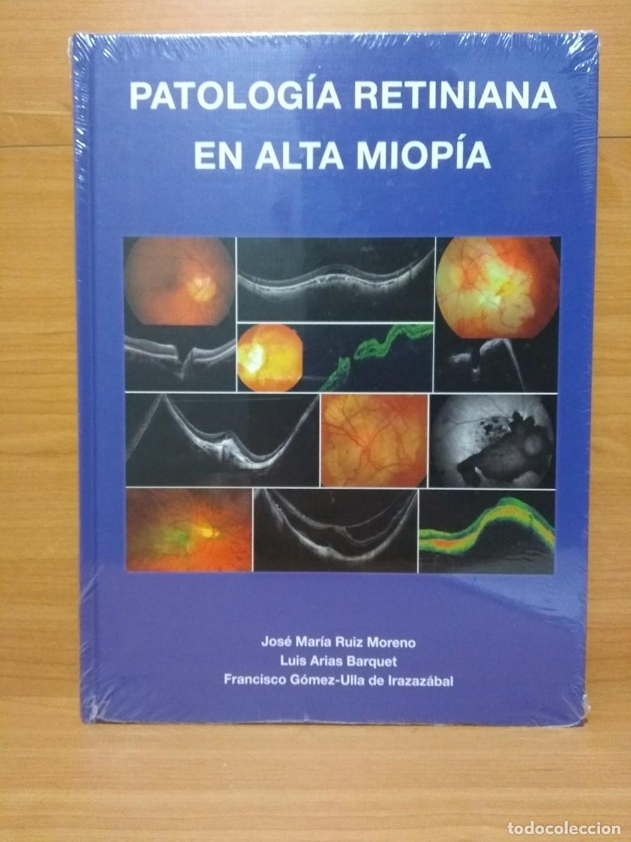 Second hand books: PATOLOG&Iacute;A RETINIANA EN ALTA MIOP&Iacute;A. Jos&eacute; Mar&iacute;a Ruiz Moreno y otros.