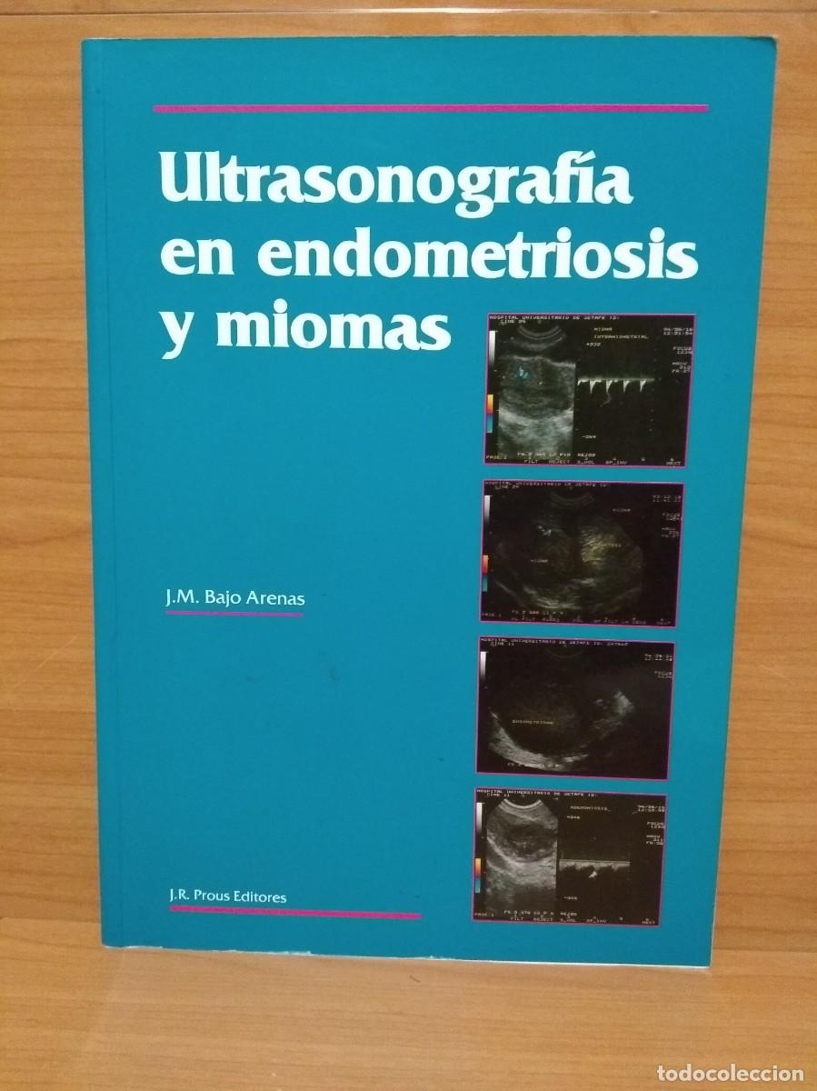 Second hand books: ULTRASONOGRAF&Iacute;A EN ENDOMETRIOSIS Y MIOMAS. J. M. BAJO ARENAS. J. R. Prous, 1994.