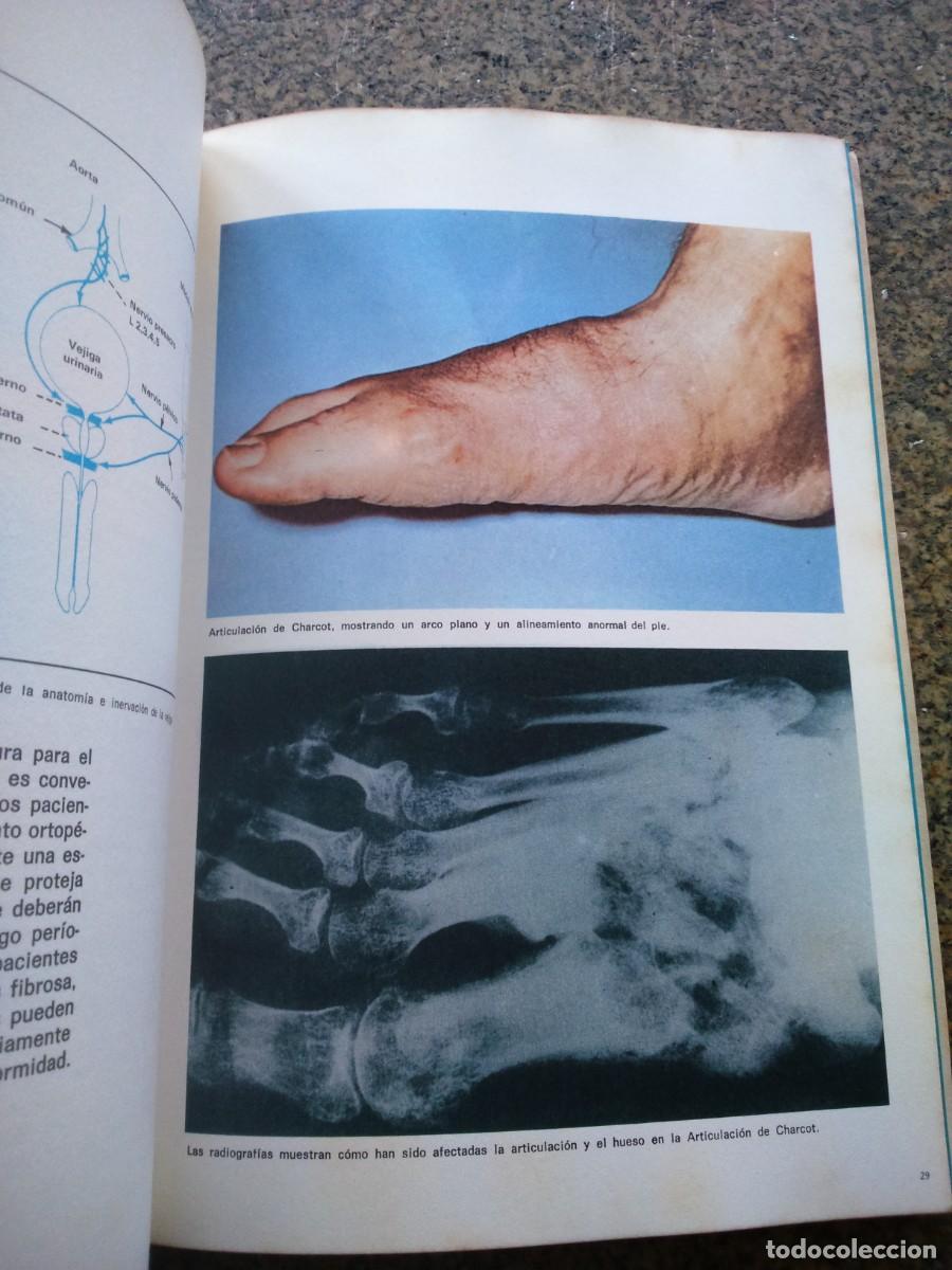 Libros de segunda mano: IMPLICACIONES DE LA HIPERGLUCEMIA -- PFIZER 1972 -- - Foto 2