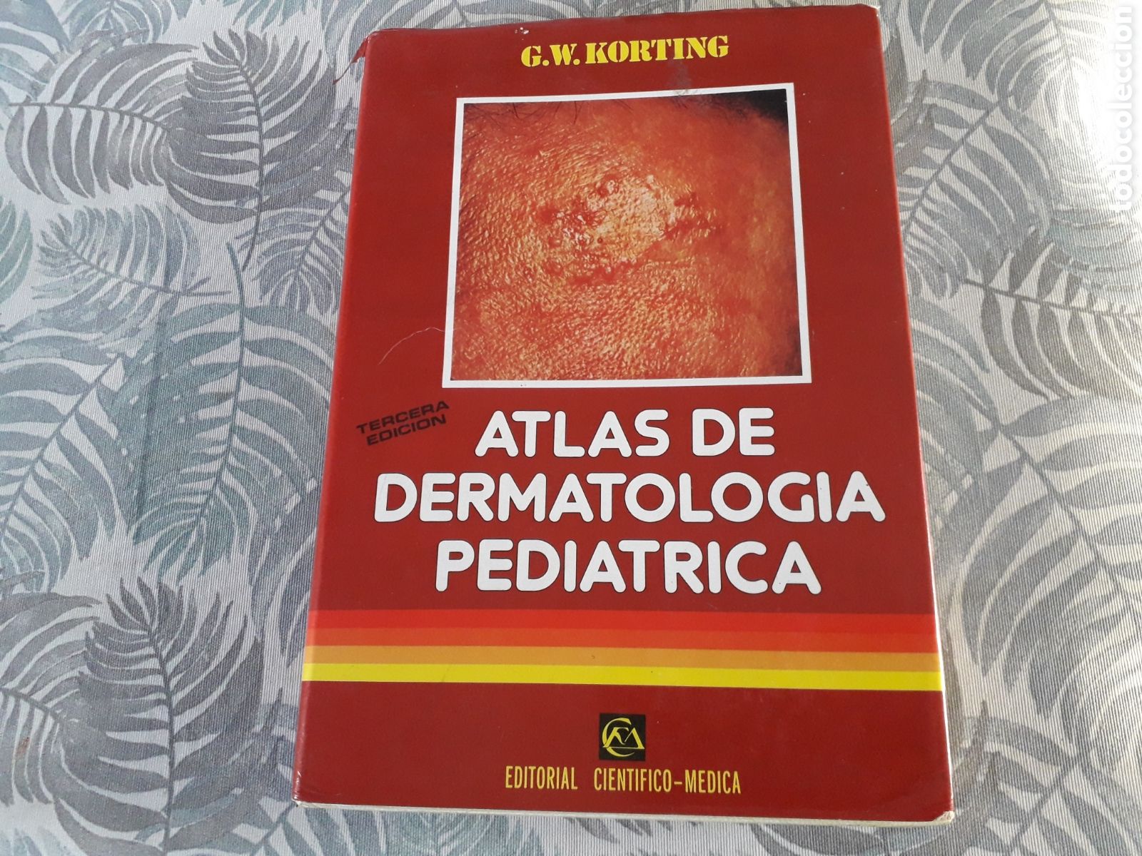 Second hand books: ATLAS DE DERMATOLOG&Iacute;A PEDIATRICA, G.W. KORTING,