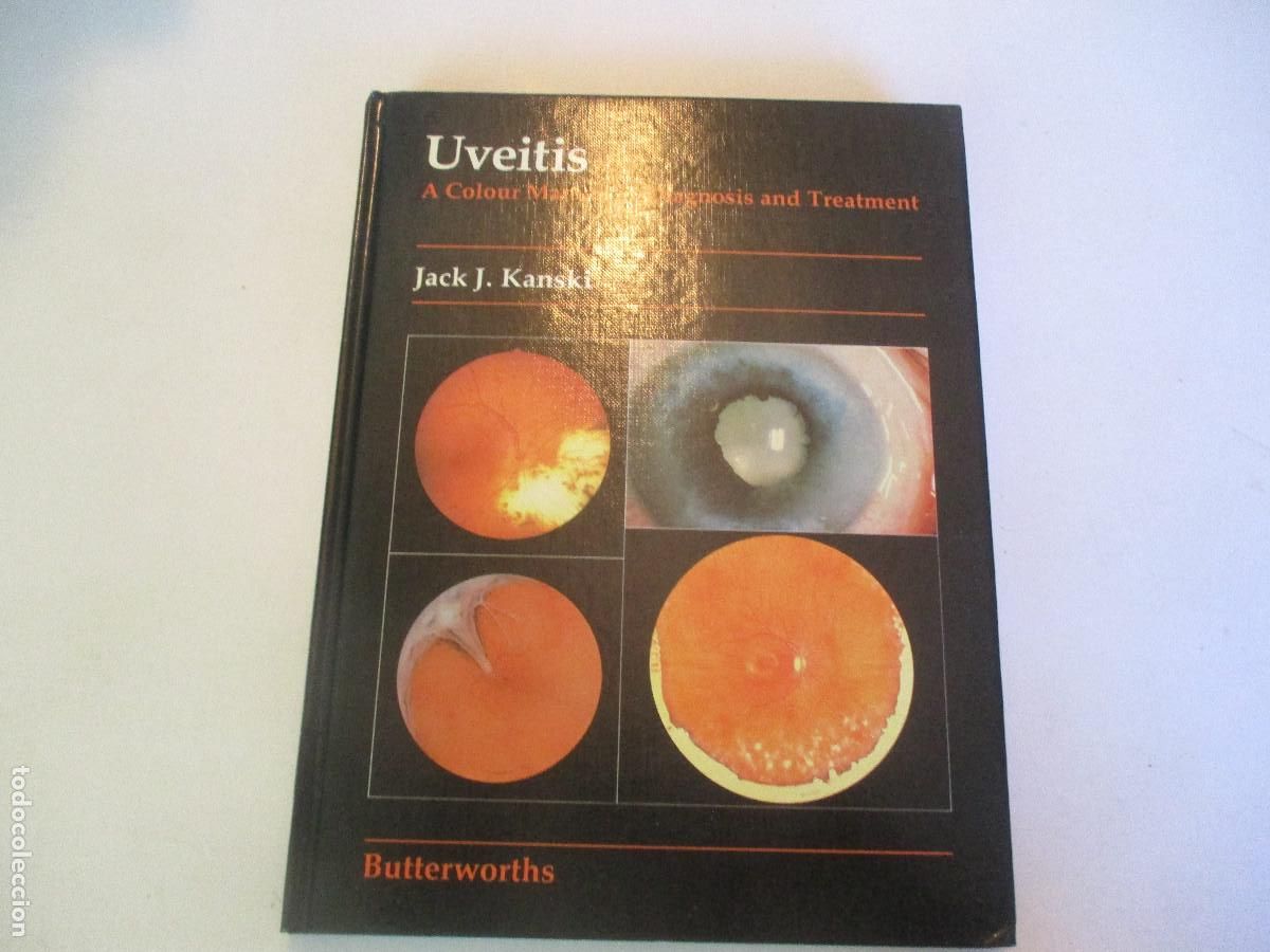 Libros de segunda mano: JACK J. KANSKI Uveitis (ingl&eacute;s) W27489 - Foto 1