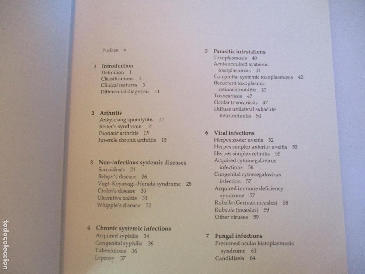 Libros de segunda mano: JACK J. KANSKI Uveitis (ingl&eacute;s) W27489 - Foto 2