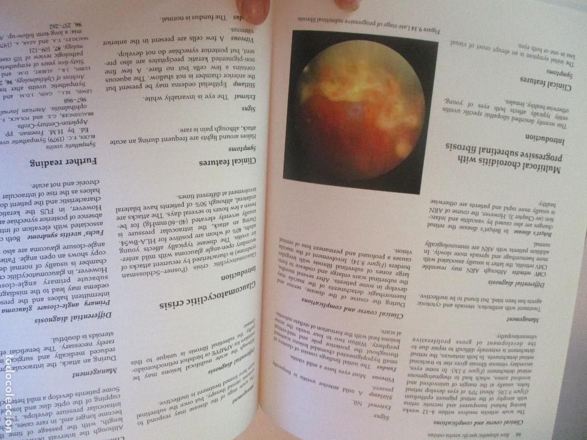 Libros de segunda mano: JACK J. KANSKI Uveitis (ingl&eacute;s) W27489 - Foto 4