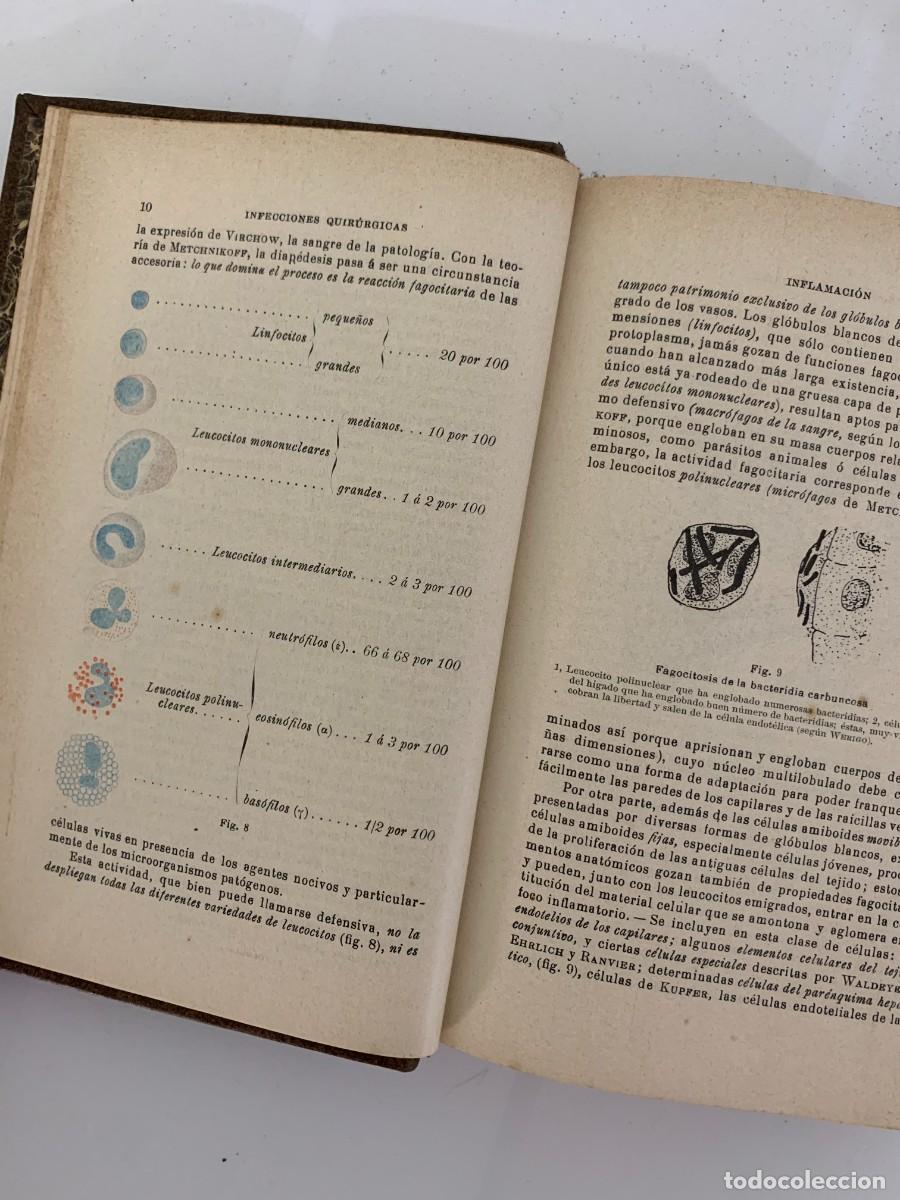 Libros de segunda mano: Manual de Patolog&iacute;a Externa - E. Forgue - Foto 4