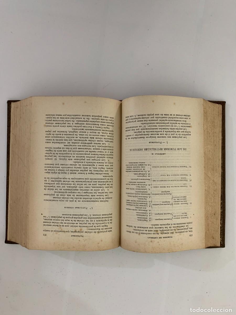 Libros de segunda mano: Manual de Patolog&iacute;a Externa - E. Forgue - Foto 5
