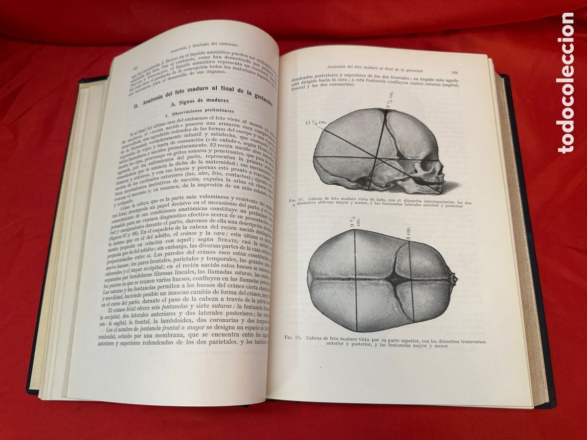 Libros de segunda mano: TRATADO DE OBSTETR&Iacute;CIA - A DODERLEIN 3 VOL&Uacute;MENES, OBRA COMPLETA - Foto 5