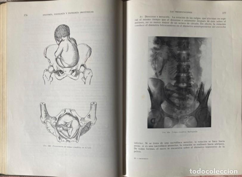 Libros de segunda mano: Manual de Obstetricia - Foto 10
