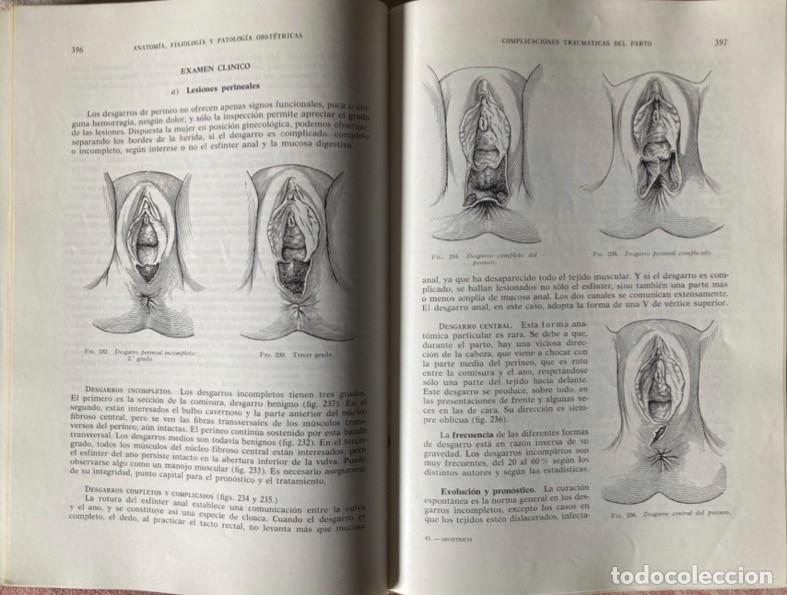 Libros de segunda mano: Manual de Obstetricia - Foto 11